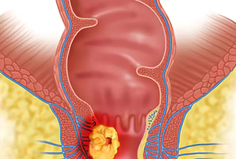 1732113949.559065_365397_image