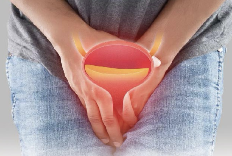 1732113973.509932_193150_image