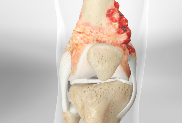 1732113985.842228_670915_image