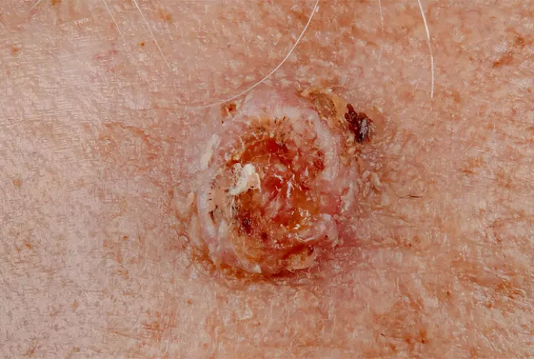 1732114019.813838_596585_image